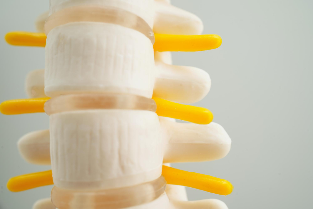 Degenerative Disc Disease